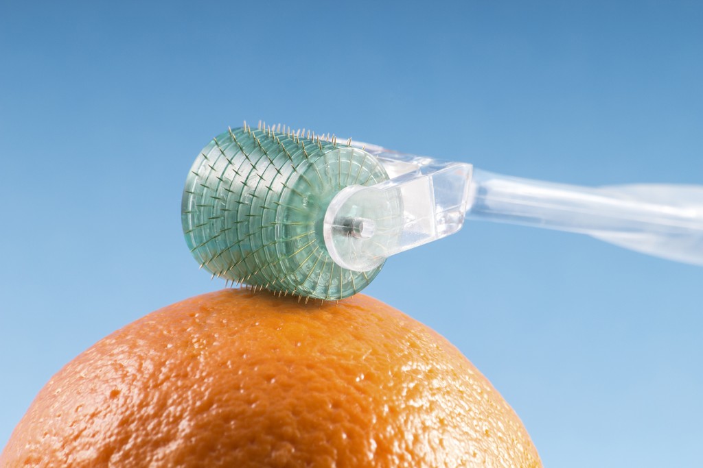 Roller de microagulhamento sobre superfície estéril
